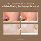 Dr.Ceuracle Vegan Kombucha Tea Essence - Image 3