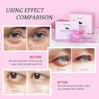 PEAUAMIE Under Eye Patchs Rose Eye Mask - Image 5