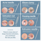 JPNK Blackhead Remover Comedone Extractor Acne Removal Kit.. - Image 3