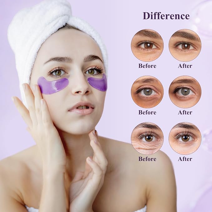 Under Eye Patches, Under Eye Mask - Image 3