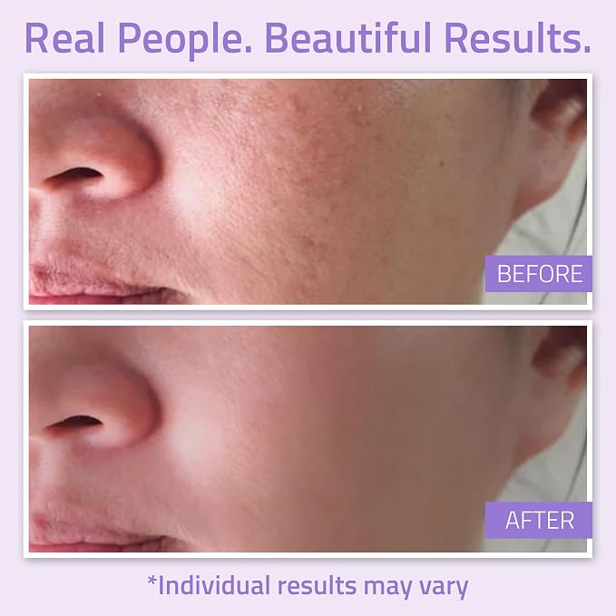 YEOUTH Hydrating Toner for Face Spray - Image 4