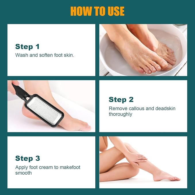 Foot Files Foot Scrubber Pedicure, Stainless Steel Callus Remover - Image 6