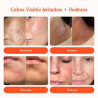 Tower 28 Jumbo SOS Daily Rescue Facial Spray - Image 2
