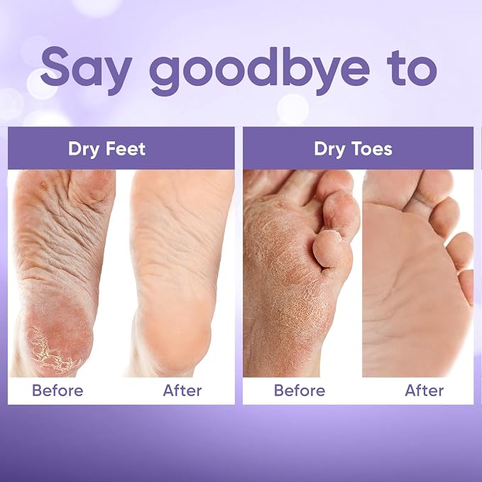 CÉLOR Foot Peeling Mask for Dry Cracked Feet | Foot Mask to Exfoliate Rough - Image 5