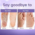 CÉLOR Foot Peeling Mask for Dry Cracked Feet | Foot Mask to Exfoliate Rough - Image 5