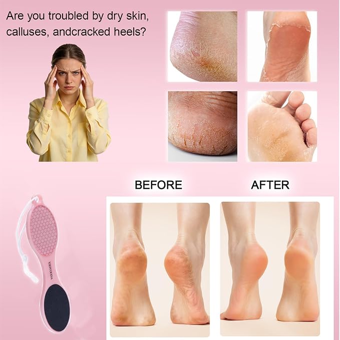 4-in-1 Nano Glass Foot Callus Remover, Professional Foot File, Durable Foot - Image 5