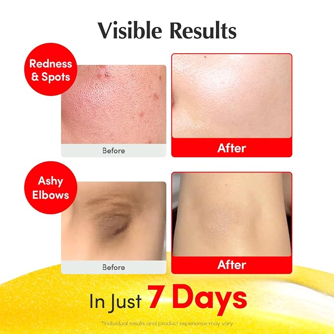 EQQUALBERRY Vitamin Illuminating Serum | Niacinamide 4% + Brightening Vitamin C - Image 4