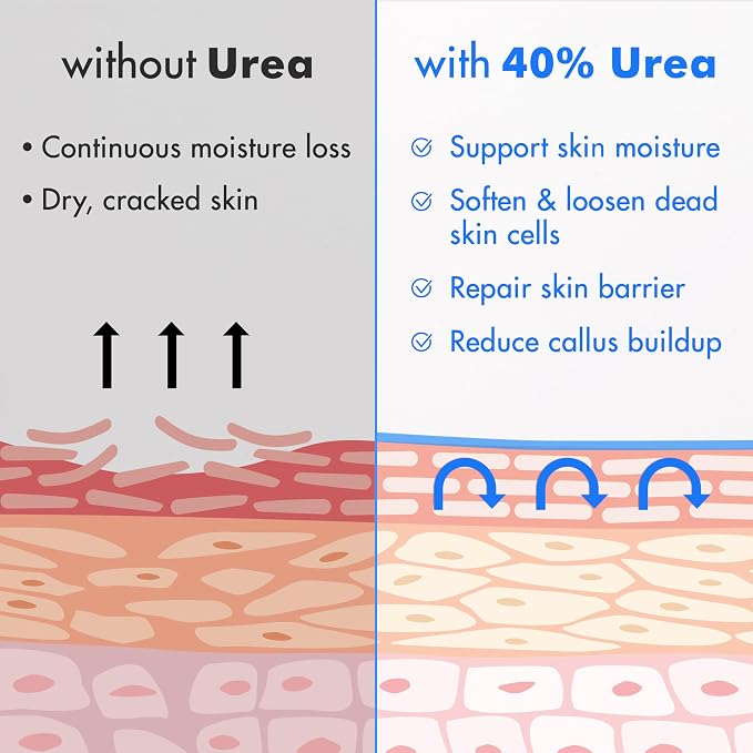 Ebanel Urea Cream 40% plus Salicylic Acid 2%, Foot Cream - Image 5
