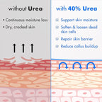 Ebanel Urea Cream 40% plus Salicylic Acid 2%, Foot Cream - Image 5