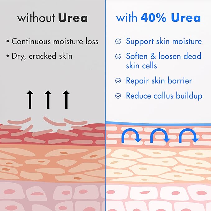 Ebanel Urea Cream 40% plus Salicylic Acid 2%, Foot Cream - Image 5