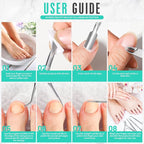 FANDAMEI Ingrown Toenail Removal Kit, Pedicure Tools, Nail Care Kit, Cuticle - Image 7
