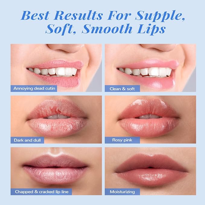 ANAI RUI Lip Therapy Set, Lip Scrub & Lip Mask, Overnight Moisturizing Lip Care - Image 7