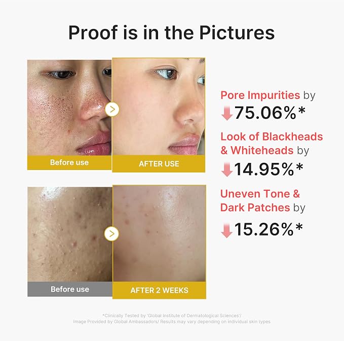 medicube Peel Shot with Kojic Acid Turmeric | Reset in One Step | Gentle - Image 4