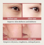 6-Piece Hydrating Skincare Set - Image 7