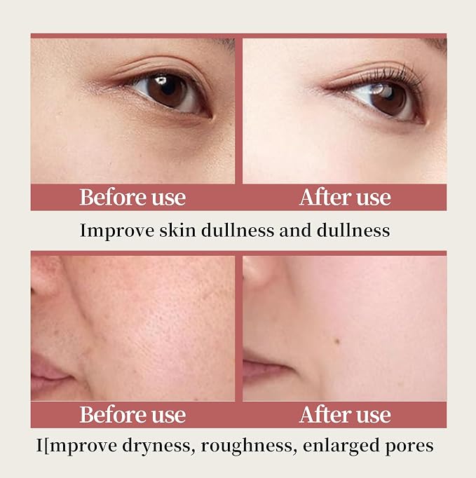6-Piece Hydrating Skincare Set - Image 7