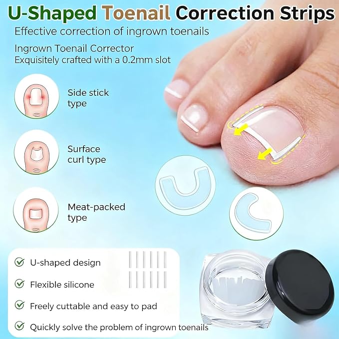 Ingrown Toenail Corrector Set - Image 5