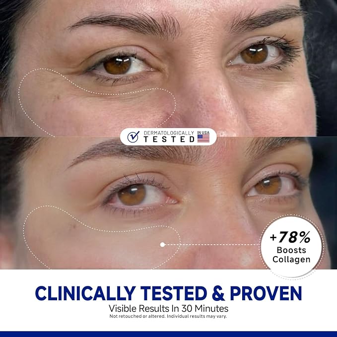 Peptide Under Eye Patches, Firming Eye Patches Instant Reduces Dark Circles and - Image 2