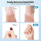 Electric Callus Remover for Feet, 2 in 1 Cordless Foot File Grinder Scrubber - Image 7