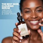 Vitamin C Serum for Face with Retinol & Salicylic Acid – Skin Clearing Acne - Image 7