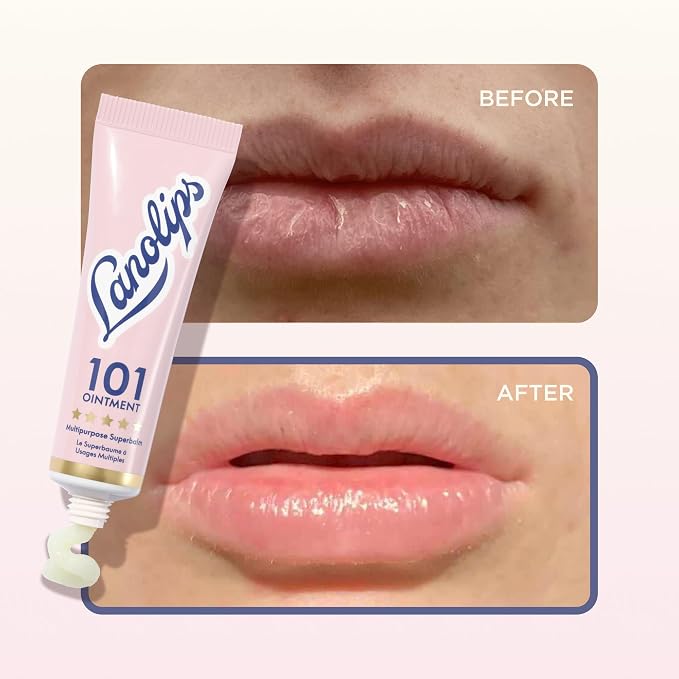 Lanolin 101 Multipurpose Ointment - Image 6