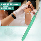 Disposable Sterile Scalpel #11, Podiatry & Professional Corn Callous Knife - Image 6