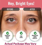 Hydro-gel Eye Patches - Image 2