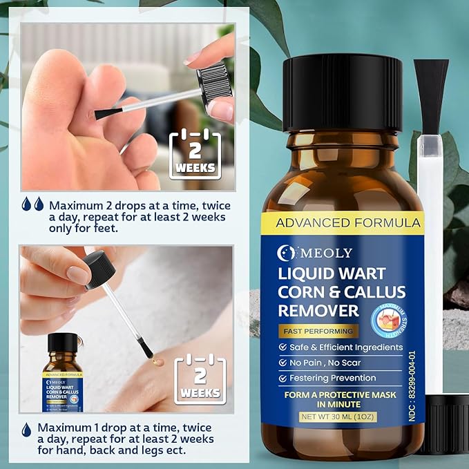 MEOLY Fast-Acting Wart Remover Freeze Off : Salicylic Acid Wart Remover - Image 5