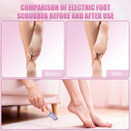 Pedicure Tool, Foot Callus Remover, Electric Pedicure Set, Foot Care, Removes - Image 5