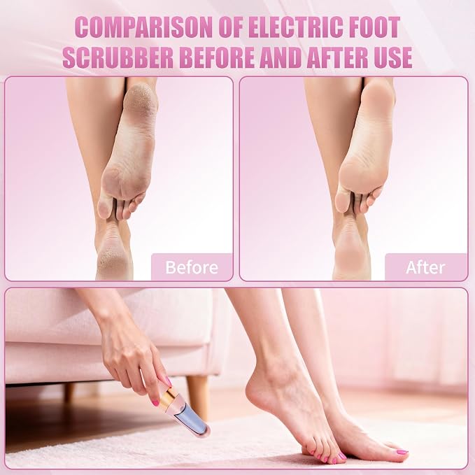 Pedicure Tool, Foot Callus Remover, Electric Pedicure Set, Foot Care, Removes - Image 5