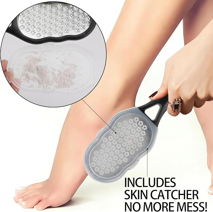 2 Pcs Foot Files with Skin Catcher, Stainless Steel Foot Rasp Callus Remover - Image 4