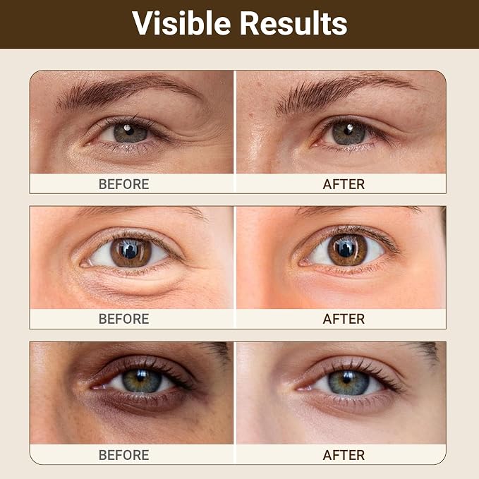 iMethod 3PDRN & Retinol Eye Patches, Hydrogel Under-Eye Masks - Image 3