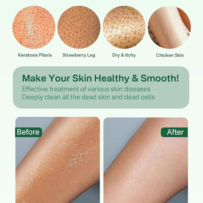 Yiclick Heavy Exfoliating Gloves, Exfoliating Body Scrubber - Image 5