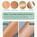 Yiclick Heavy Exfoliating Gloves, Exfoliating Body Scrubber - Image 5