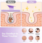 Silicone Face Scrubber 2 Pack, Manual Facial Cleansing Brush - Image 5