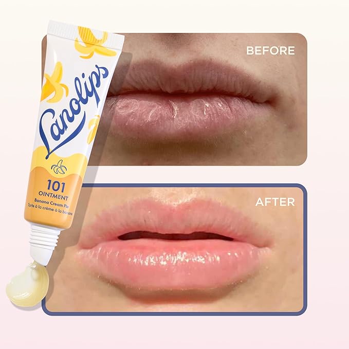 Lanolin 101 Multipurpose Ointment - Image 5