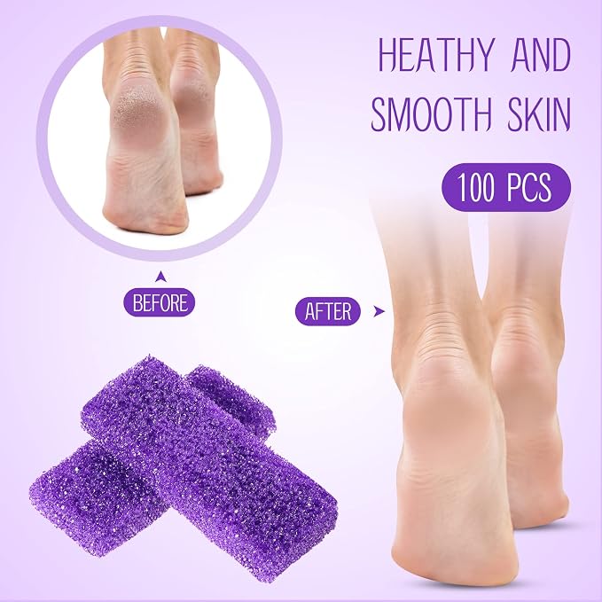 Batiyeer 100 Pcs Pumice Stone for Feet Scrubber Dead Skin Disposable Foot - Image 4