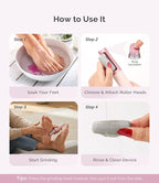MelodySusie Electric Callus Remover - Image 7