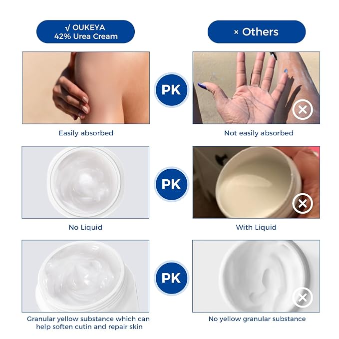 OUKEYA Urea Cream 42% plus Salicylic Acid 2% Net 12.35 Oz Foot & Hand Cream - Image 6