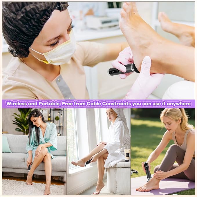 Electric Foot Callus Remover - Image 5