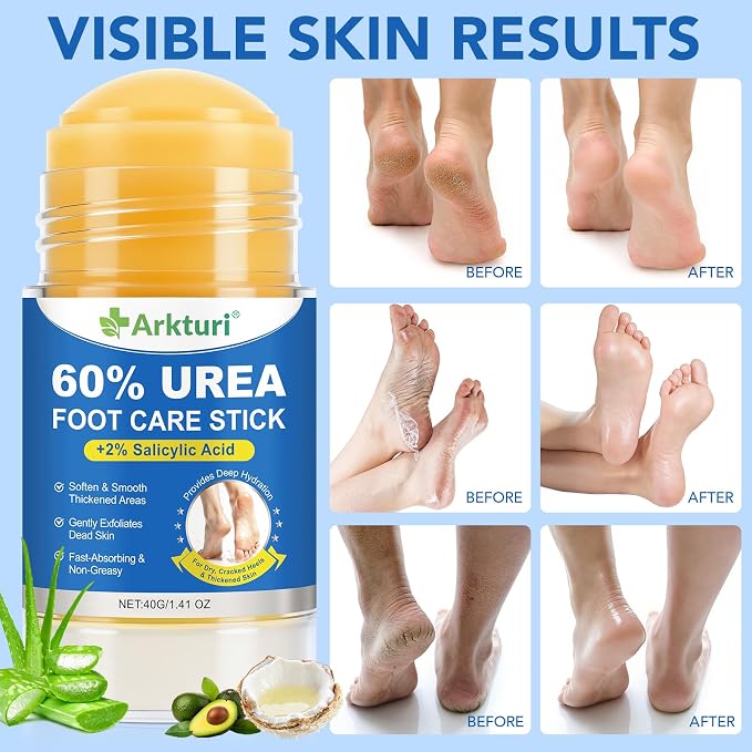 ABOUME 60% Urea Foot Care Stick - Image 4