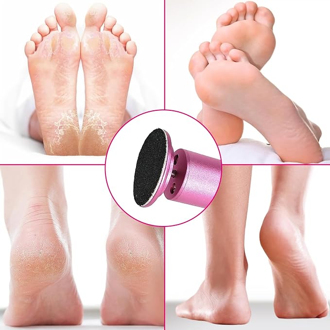 Electric Foot Callus Remover, Adjustable Foot Speed, Professional Foot Repair - Image 2