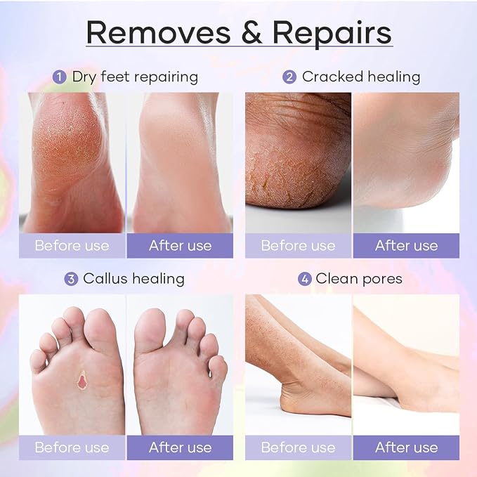 Deluxe 6 Step Pedicure Kit - Image 9
