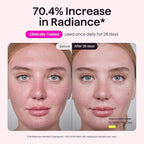 wavytalk Red Light Therapy Mask - Image 5