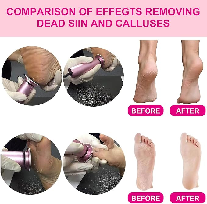 Electric Foot Callus Remover, Adjustable Foot Speed, Professional Foot Repair - Image 4