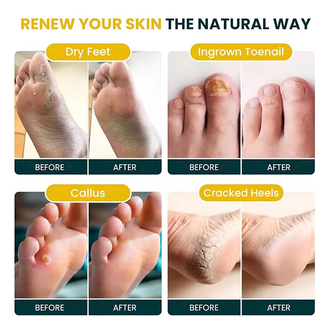 FOOT CURE Tea Tree & Citrus Foot Soak - Image 4