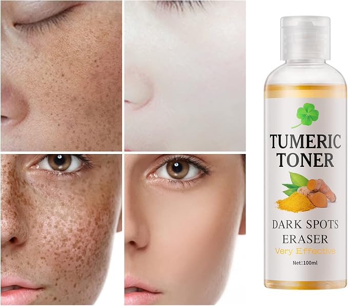 Toner for Dark Spots Turmeric Dark Spot Corrector, Facial Toner for Acne Prone - Image 3