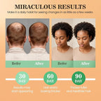 Batana Oil for Hair Growth Dr Sebi, 100% Raw Organic Batana Hair Mask from - Image 4
