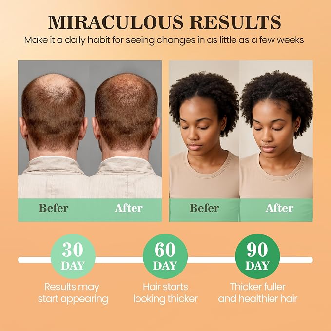 Batana Oil for Hair Growth Dr Sebi, 100% Raw Organic Batana Hair Mask from - Image 4
