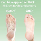 Dr. Entre's Callus Remover Gel Kit - Image 5