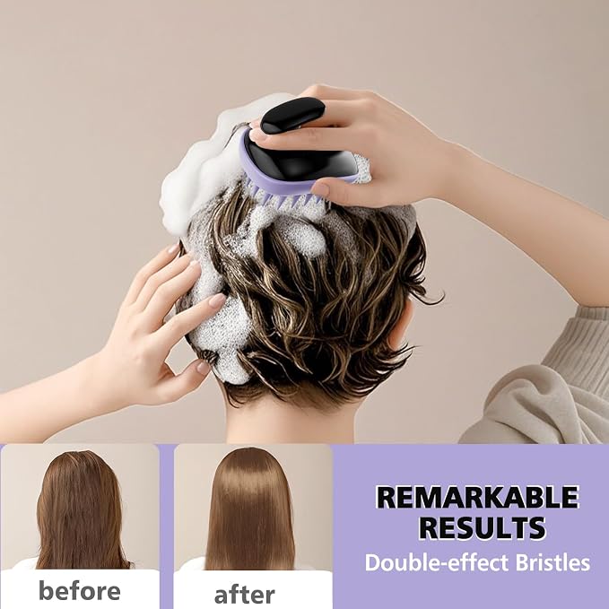 2-in-1 Scalp Massager Shampoo Brush, Scalp Scrubber, Exfoliator Brush - Image 6